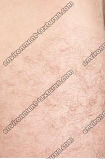 human skin hairy 0006